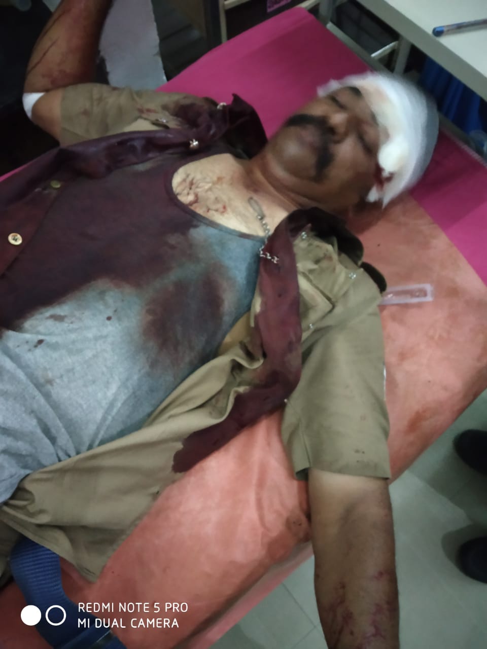 காவலருக்கு அரிவாள் வெட்டு